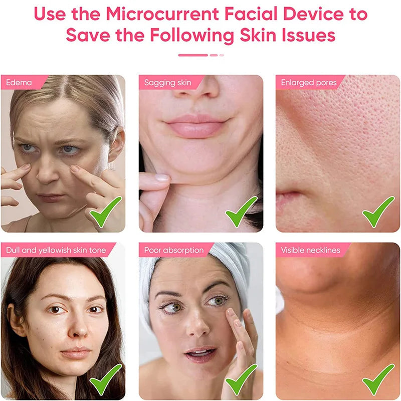 EMS Facial Massager Roller Microcurrent Face Lifting Machine , Anti-Wrinkle Beauty Device