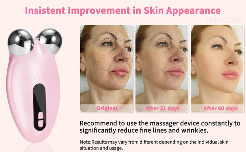 EMS Facial Massager Roller Microcurrent Face Lifting Machine , Anti-Wrinkle Beauty Device